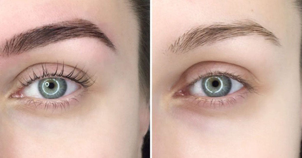 The Ultimate Guide to Eyebrow Removal