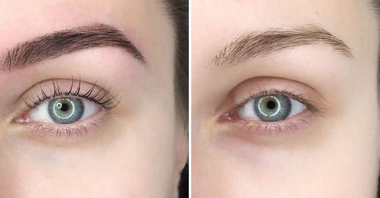 The Ultimate Guide to Eyebrow Removal