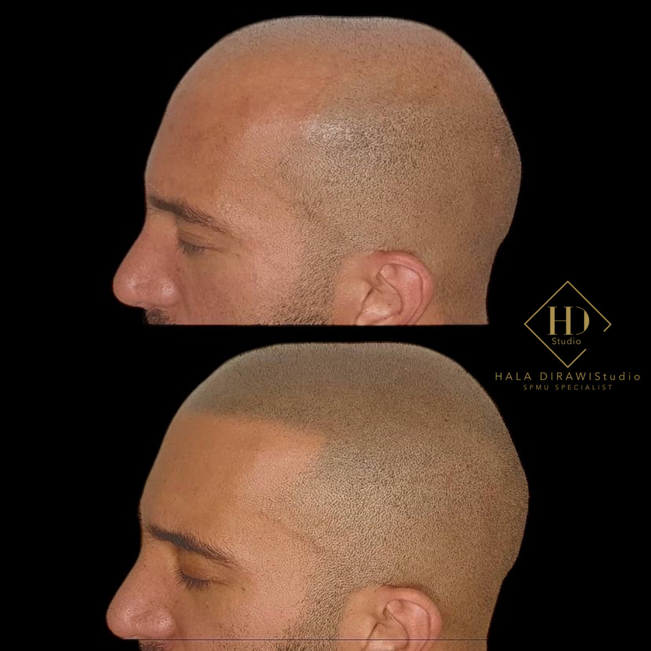 BOOK YOUR APPOINTMENT - HDS