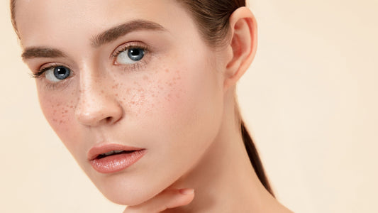 Dubai’s Top Skin Camouflage Treatments Explained