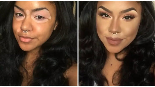 Skin Camouflage Makeup: Confidence Starts Here