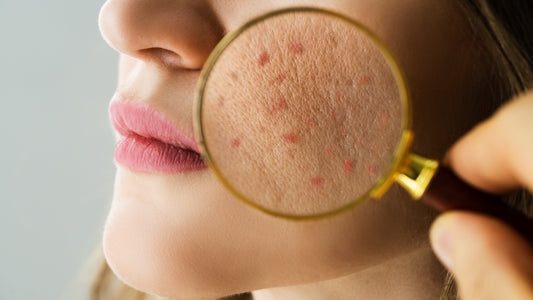 Skin Camouflage – Restore Confidence with Professional Solutions