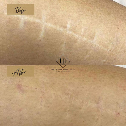 BOOK YOUR APPOINTMENT - HDS